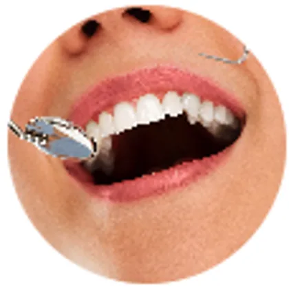 Close-up dental examination with a mirror